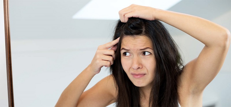 Natural remedies to fight dandruff and dry fat