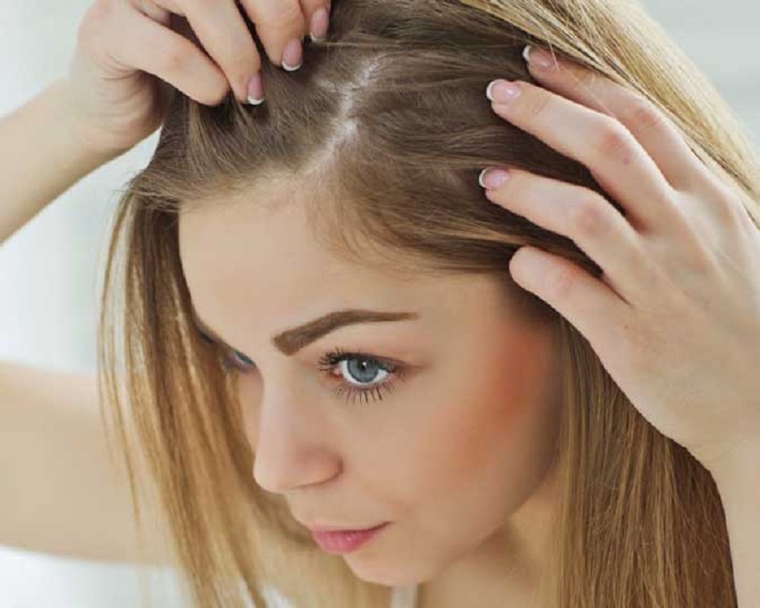 Tips for Coping With Thinning Hair