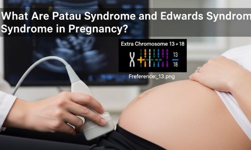 What Are Patau Syndrome and Edwards Syndrome in Pregnancy?